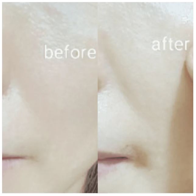 Veritana Pink Intensive Firming Mask – 100 Units